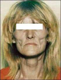 crack head.jpg